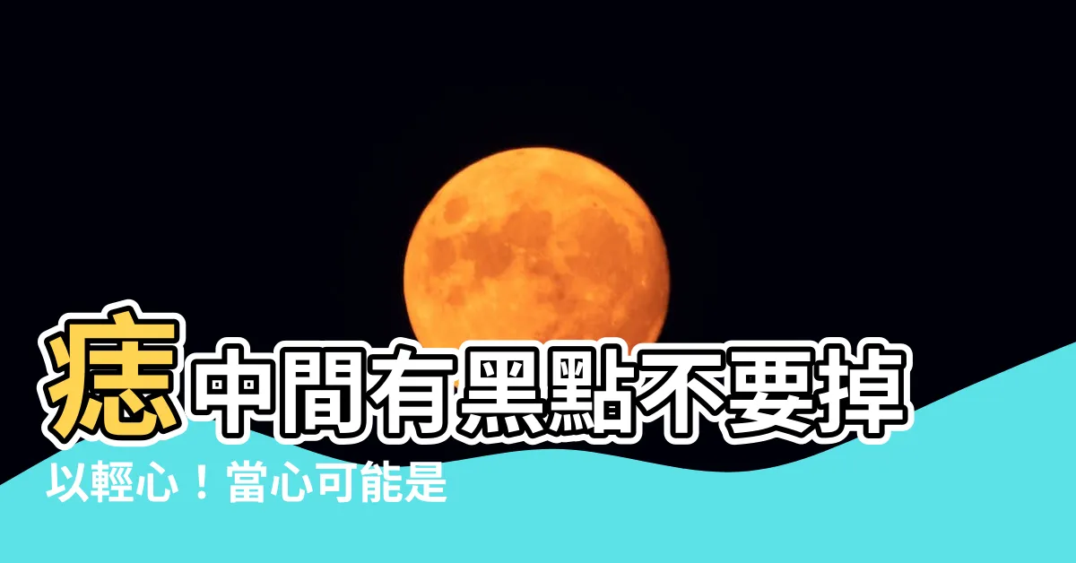【痣中間有黑點】痣中間有黑點不要掉以輕心！當心可能是惡性黑色素瘤