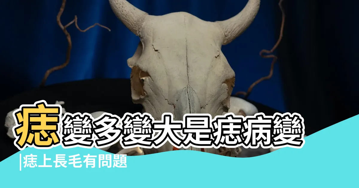 【凸痣長毛】痣變多變大是痣病變 |痣上長毛有問題嗎 |哪些痣會變成癌 |