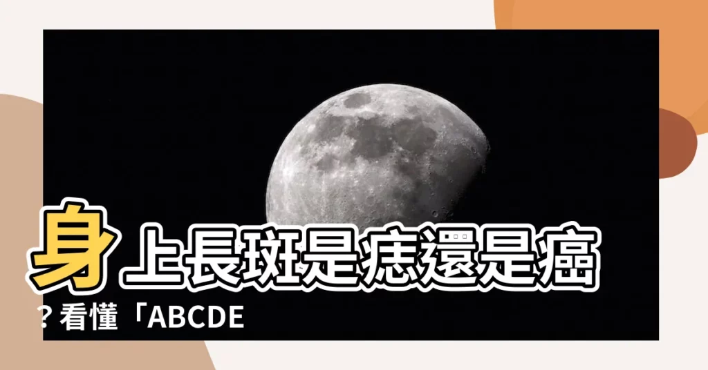 【身上長斑】身上長斑是痣還是癌？看懂「ABCDE守則」秒辨識