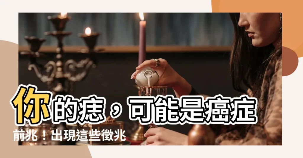 【身上的痣】你的痣，可能是癌症前兆！出現這些徵兆，小心黑色素瘤找上門