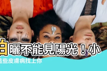 【不能曬太陽的病】怕曬不能見陽光！小心這些皮膚病找上你