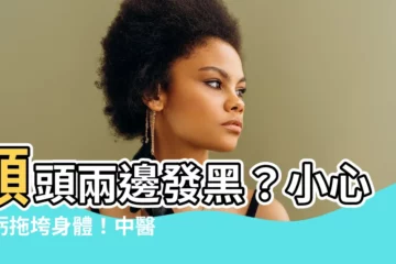 【額頭兩邊發黑】額頭兩邊發黑？小心腎虧拖垮身體！中醫教你一招改善！