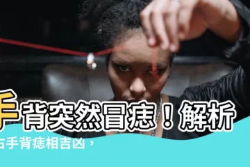 【手背突然長痣】手背突然冒痣！解析左右手背痣相吉凶，影響你的財運和健康