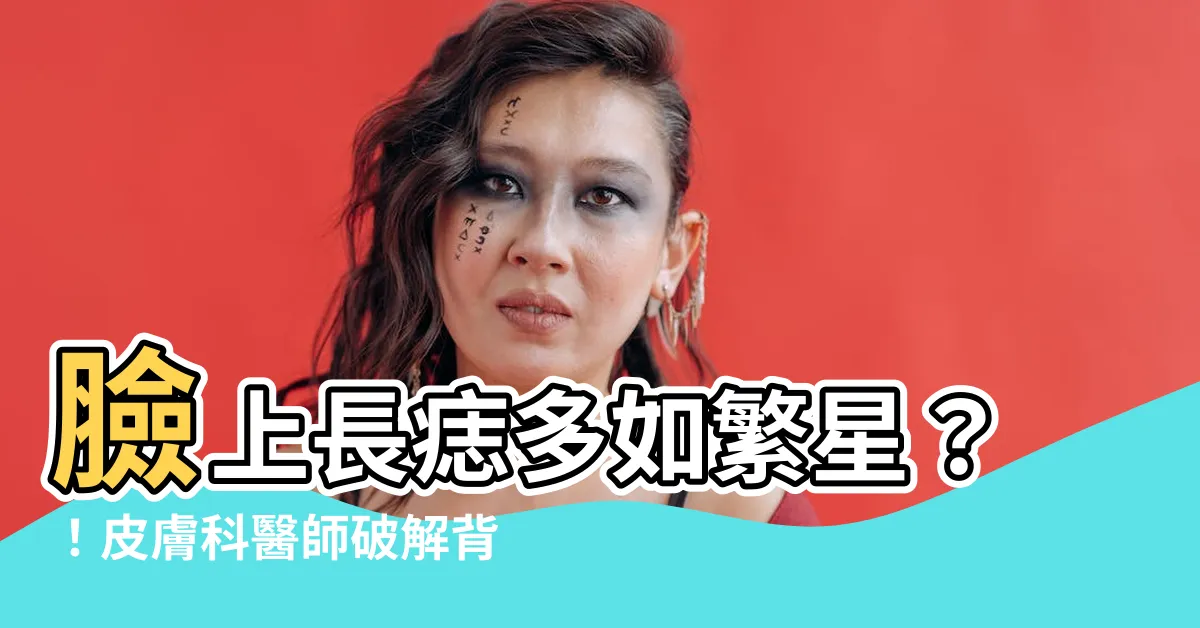 【臉 長痣】臉上長痣多如繁星？！皮膚科醫師破解背後原因