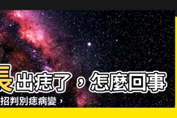 【長出痣】長出痣了，怎麼回事？5招判別痣病變，3招自我檢測皮膚癌