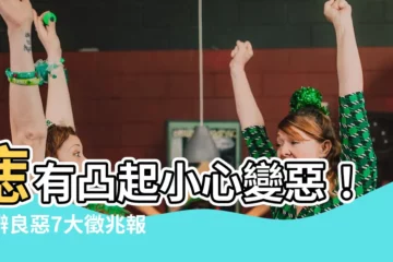 【痣有凸起】痣有凸起小心變惡！分辨良惡7大徵兆報你知