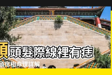 【額頭髮際線中間長痣】額頭髮際線裡有痣 |額頭痣相命理詳解看看吧 |額頭髮際線正中間有痣 |