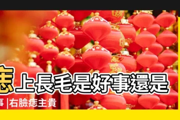 【女人右額頭長痣長毛】痣上長毛是好事還是壞事 |右臉痣主貴是什麼意思 |女人額頭上有痣好不好 |
