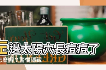 【左邊太陽穴長痘痘】左邊太陽穴長痘痘了該怎麼辦？警惕隱藏的身體健康問題！