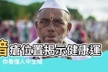 【人中生暗瘡面相】暗瘡位置揭示健康運程！你看懂人中生暗瘡是好是壞了嗎？
