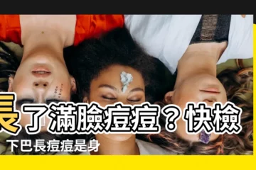 【下巴底生暗瘡】長了滿臉痘痘？快檢查！下巴長痘痘是身體在警告你！