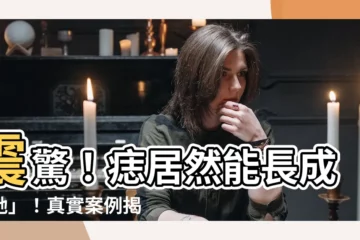 【痣作人】震驚！痣居然能長成「她」！真實案例揭秘