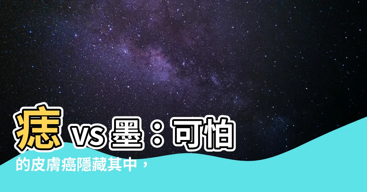 【痣 vs 墨】痣 vs 墨：可怕的皮膚癌隱藏其中，瞭解分辨方法才能安心！