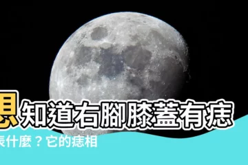 【右腳膝蓋有痣】想知道右腳膝蓋有痣代表什麼？它的痣相竟能招財又避小人！