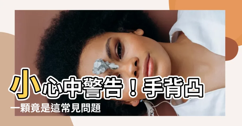 【手背凸一顆】小心中警告！手背凸一顆竟是這常見問題，復發率驚人！