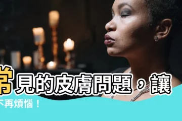 【皮膚問題】常見的皮膚問題，讓你不再煩惱！