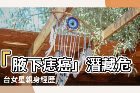 【腋下痣癌】「腋下痣癌」潛藏危機!台女星親身經歷,教你如何辨別危險黑痣!