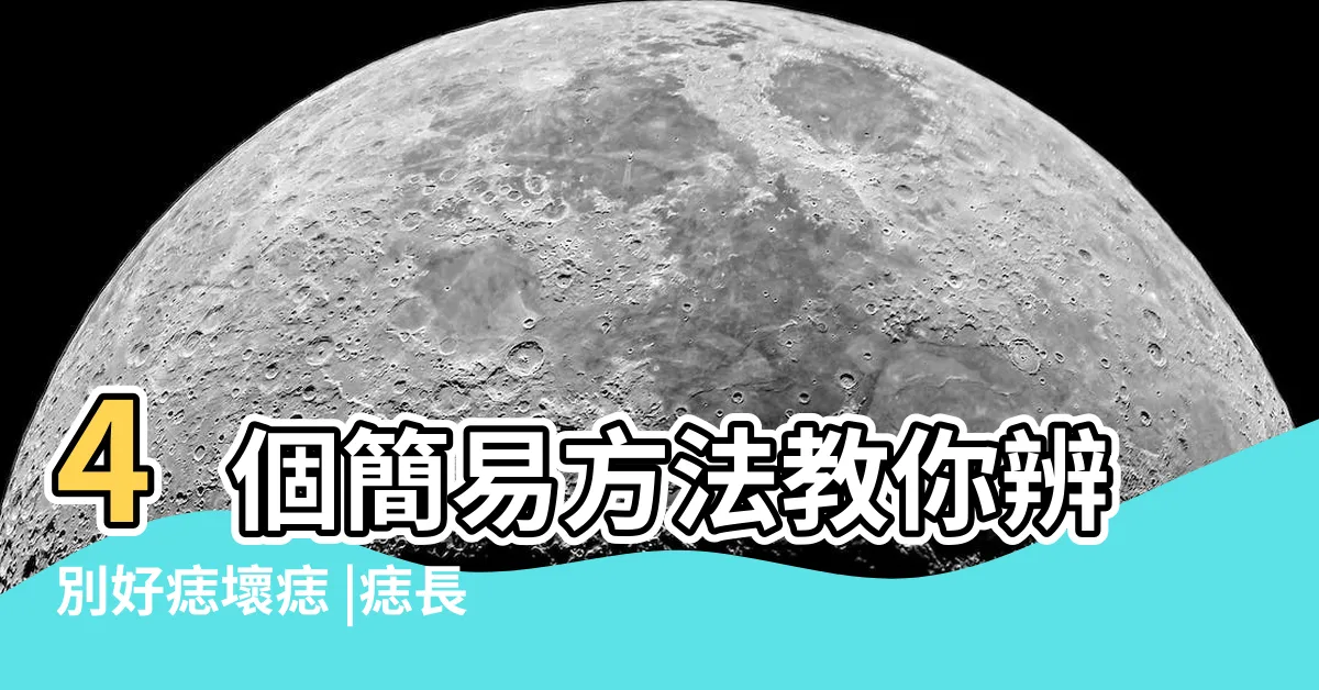 【好痣顏色】4個簡易方法教你辨別好痣壞痣 |痣長這裡致死率超高醫曝5大判斷標準 |先搞懂身上的是痣還是癌 |