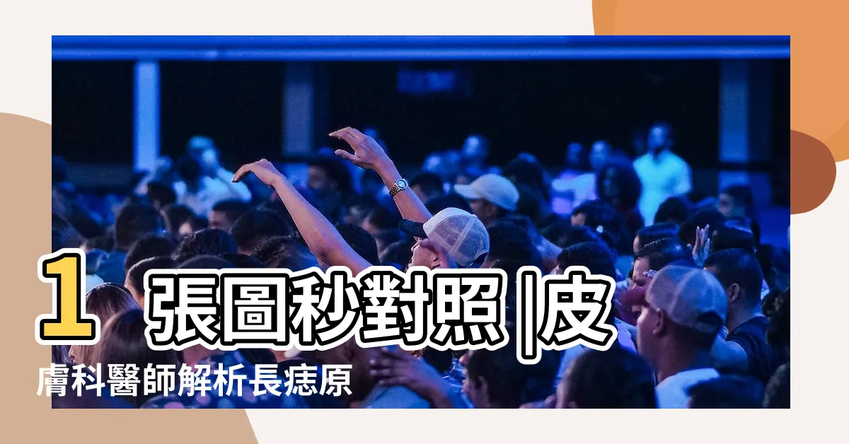 【痣 形狀】1張圖秒對照 |皮膚科醫師解析長痣原因 |為什麼臉上的痣越來越多 |