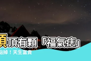 【頭頂有痣】頭頂有顆「福氣痣」 別點掉！天生富貴招貴人運