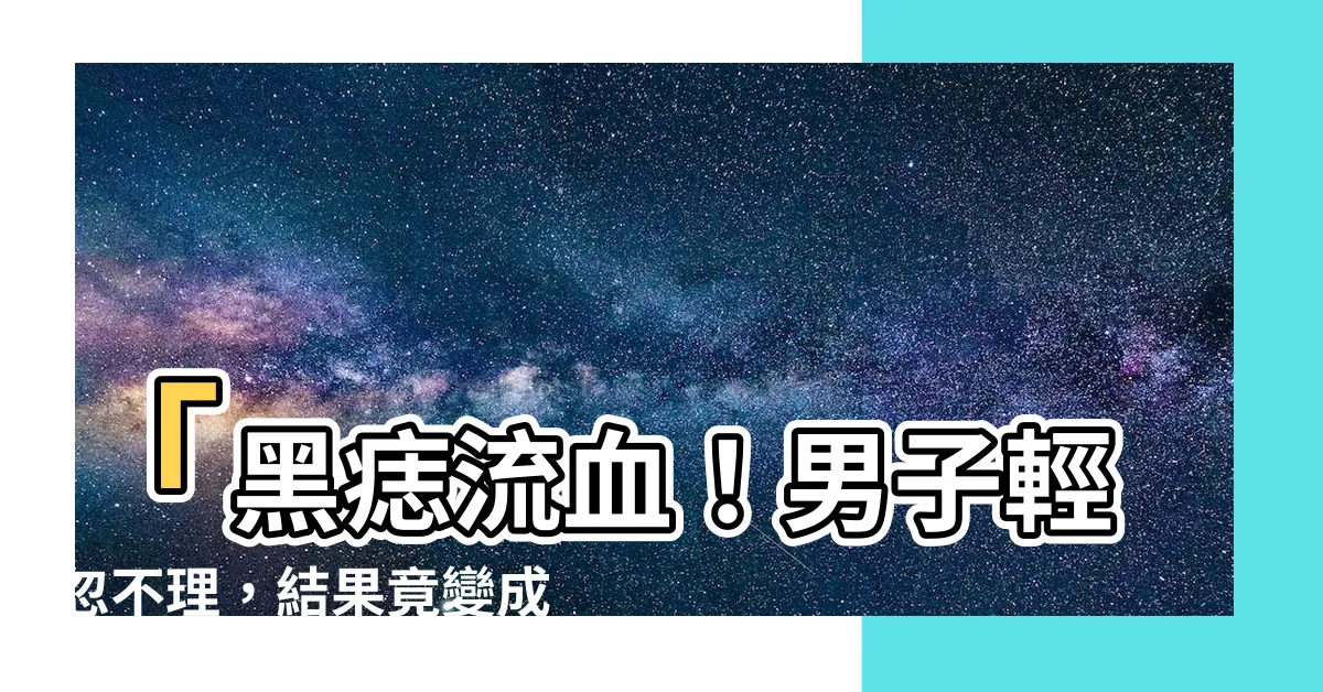 【黑痣流血】「黑痣流血！男子輕忽不理，結果竟變成骷髏頭⚠️」