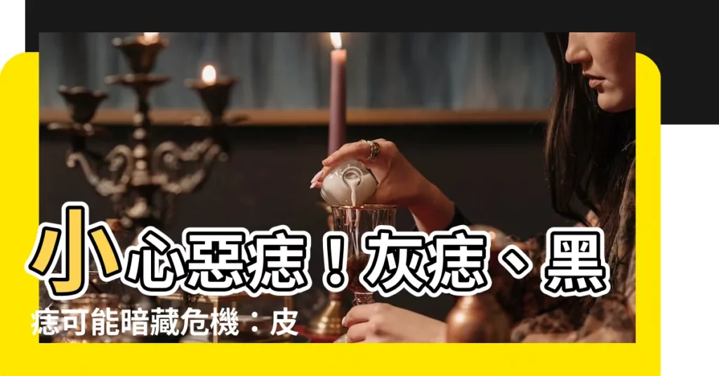 【灰痣】小心惡痣！灰痣、黑痣可能暗藏危機：皮膚科醫師教你找出假的痣