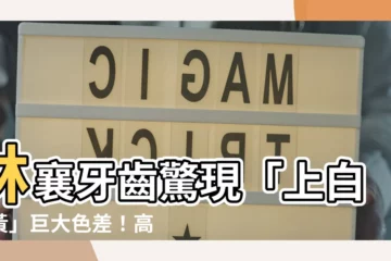 【林襄牙齒】林襄牙齒驚現「上白下黃」巨大色差！高EQ回應網笑翻