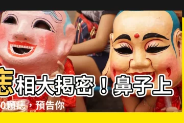 【痣 鼻子】痣相大揭密！鼻子上的10顆痣，預告你的財運吉凶