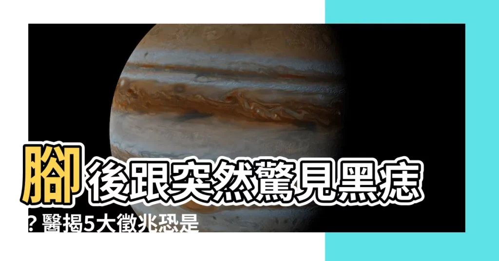 【腳後跟突然長痣】腳後跟突然驚見黑痣？醫揭5大徵兆恐是黑色素瘤！