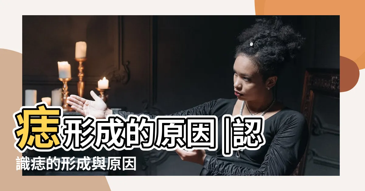 【痣 原因】痣形成的原因 |認識痣的形成與原因 |痣變多變大是痣病變 |