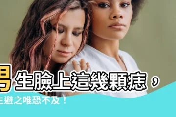 【男生 臉 痣】男生臉上這幾顆痣，女生避之唯恐不及！