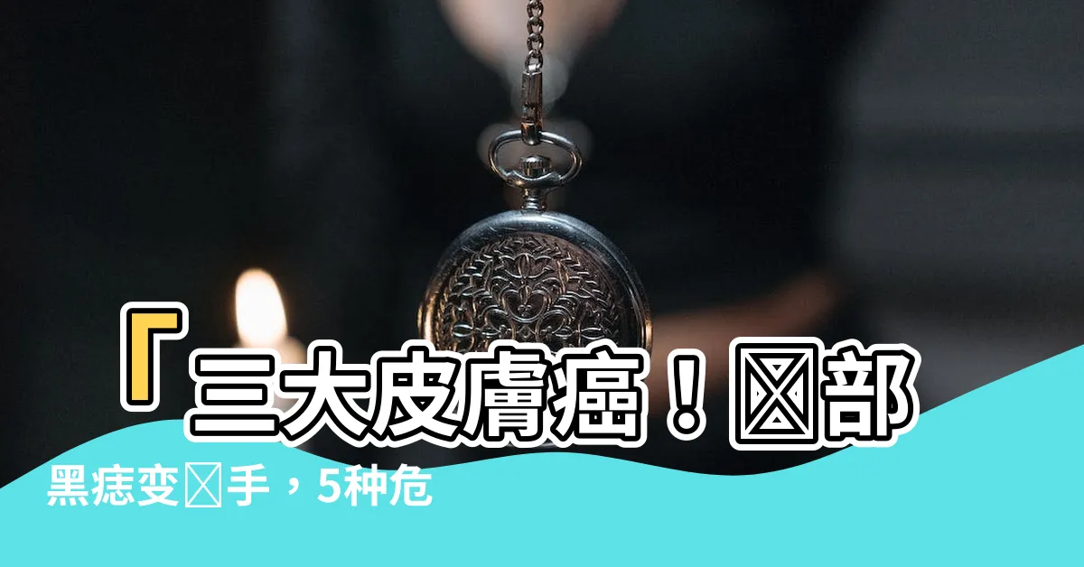 【臉部黑痣】「三大皮膚癌！臉部黑痣變殺手，5種危險痣別忽視」