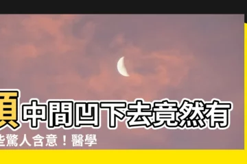 【頭中間凹下去】頭中間凹下去竟然有這些驚人含意！醫學權威曝原因令人大開眼界