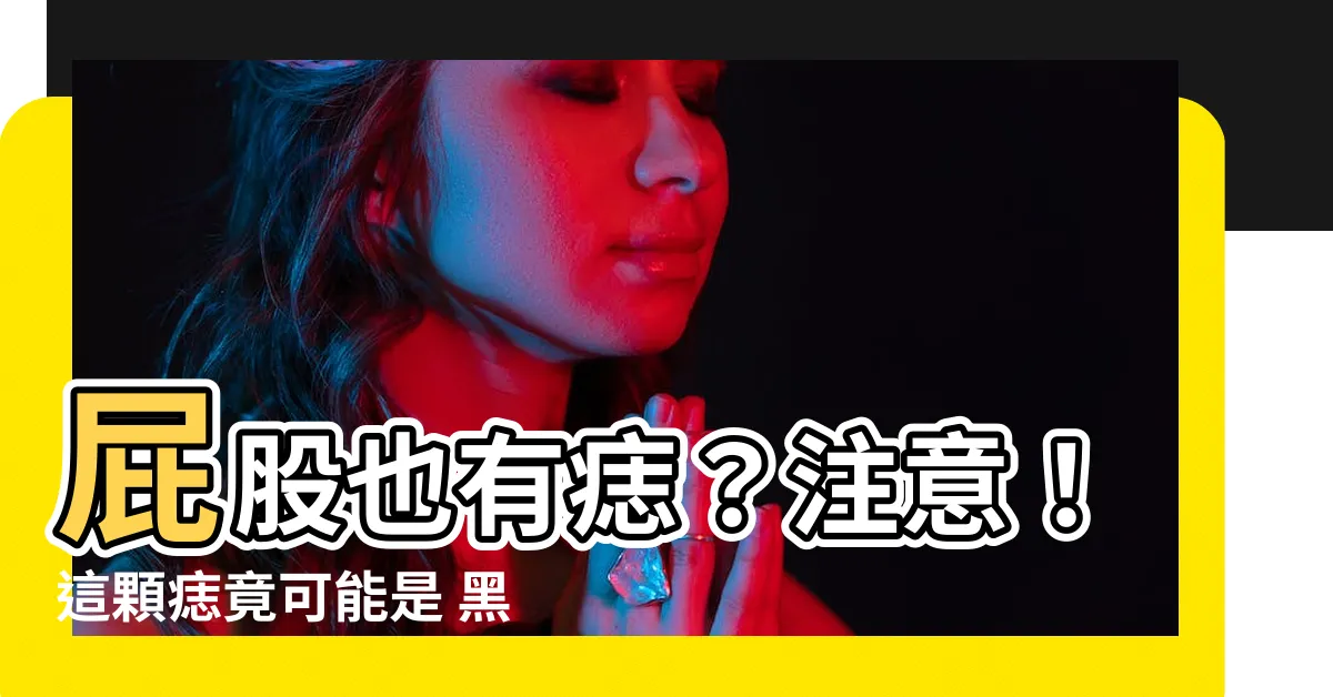 【屁股黑痣】屁股也有痣？注意！這顆痣竟可能是 黑色素癌 前兆