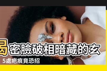 【臉破相】揭密臉破相暗藏的玄機：5處疤痕竟恐招致衰運！
