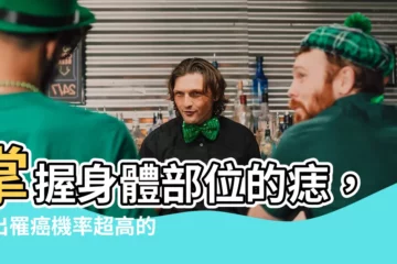 【痣 身體】掌握身體部位的痣，找出罹癌機率超高的5種痣，及早預防