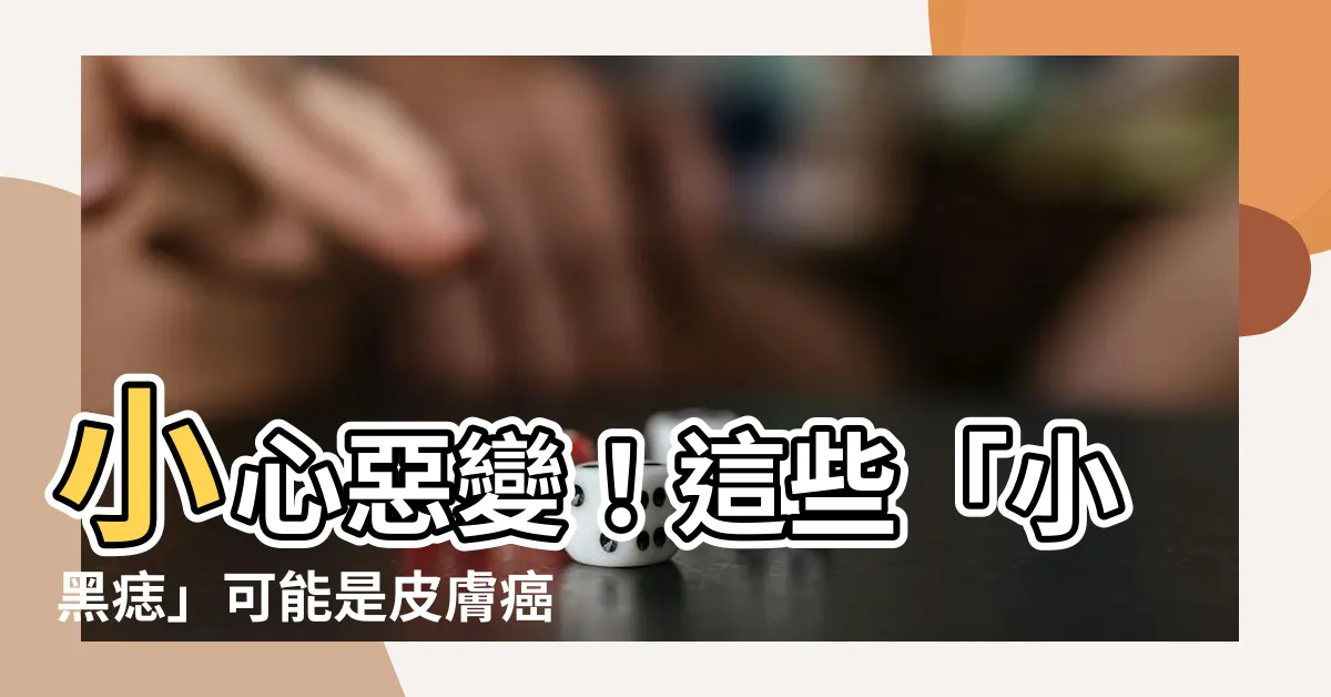 【小黑痣】小心惡變！這些「小黑痣」可能是皮膚癌的警訊