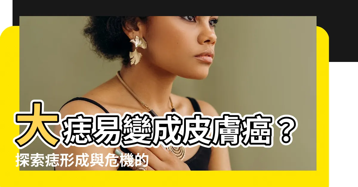 【大痣】大痣易變成皮膚癌？探索痣形成與危機的全方位解析