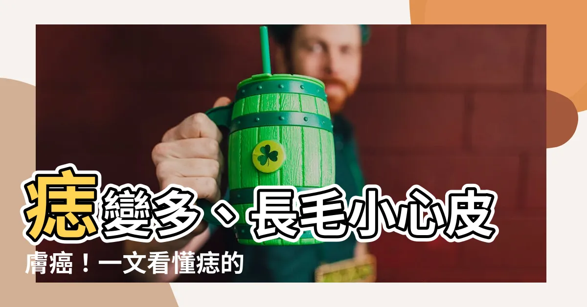 【痣 多】痣變多、長毛小心皮膚癌！一文看懂痣的形成、變化和判別病變