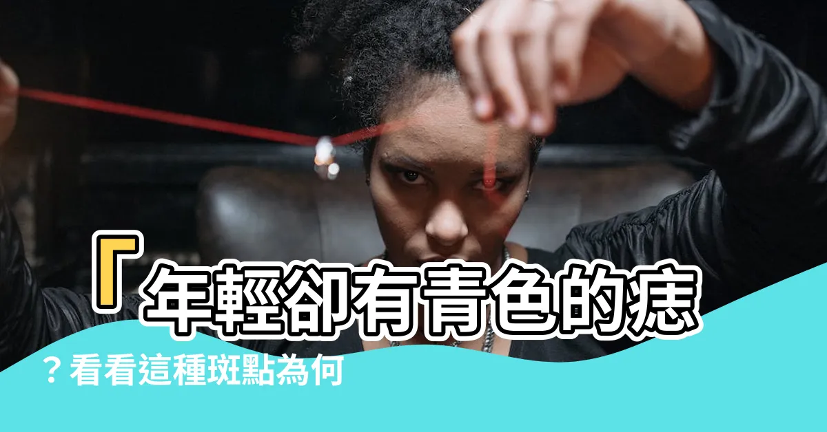 【青色的痣】「年輕卻有青色的痣？看看這種斑點為何」