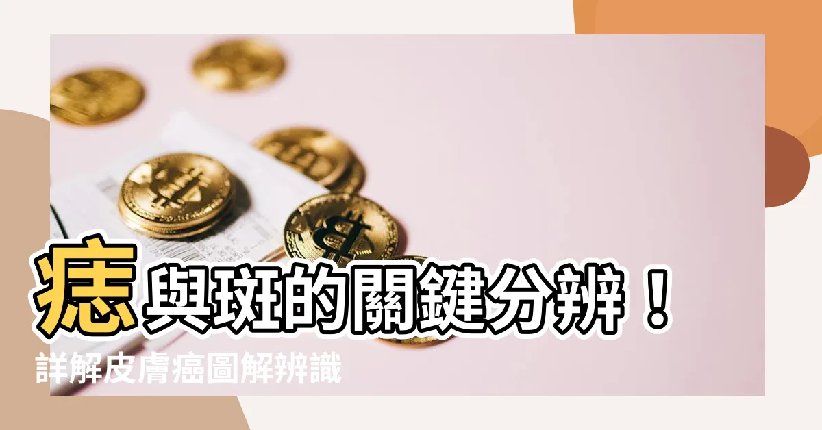 【痣 斑】痣與斑的關鍵分辨！詳解皮膚癌圖解辨識