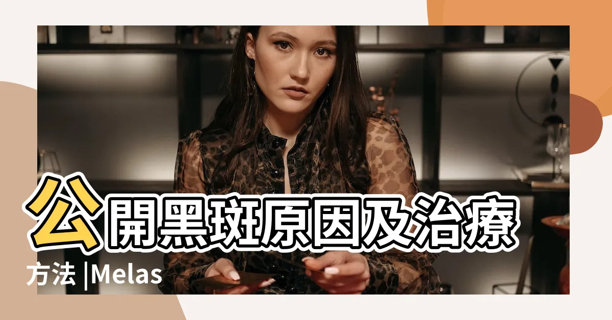 【黑斑原因】公開黑斑原因及治療方法 |Melasma |消除黑斑方法有哪些 |