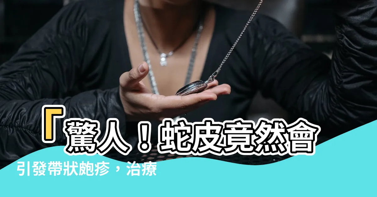 【蛇皮】「驚人！蛇皮竟然會引發帶狀皰疹，治療方法一次看！」