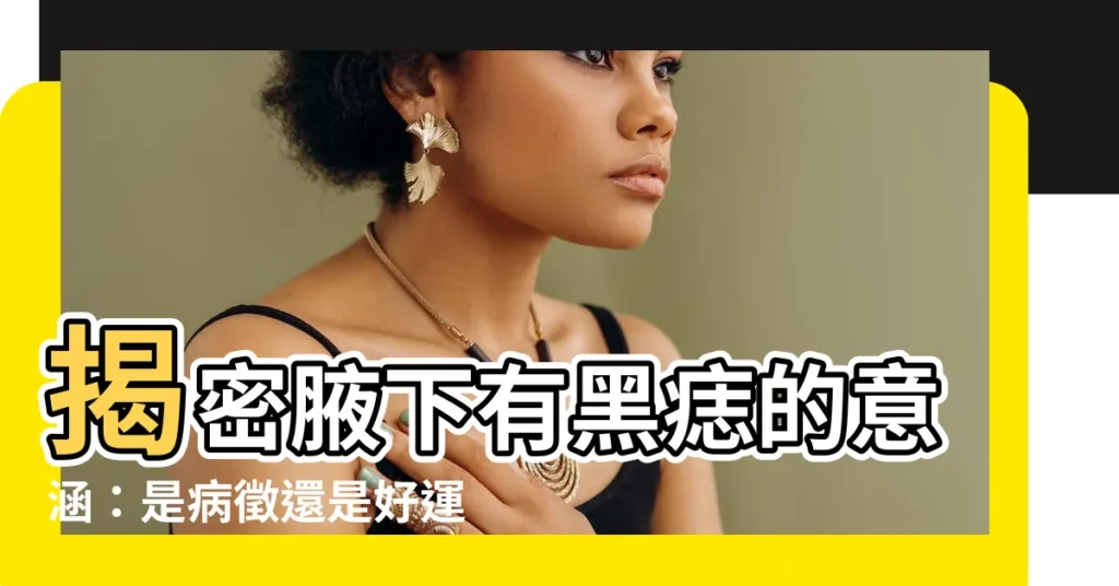 【腋下有黑痣】揭密腋下有黑痣的意涵:是病徵還是好運徵兆?