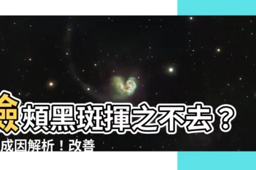 【臉頰黑斑】臉頰黑斑揮之不去？9大成因解析！改善肝斑、曬斑、室內斑