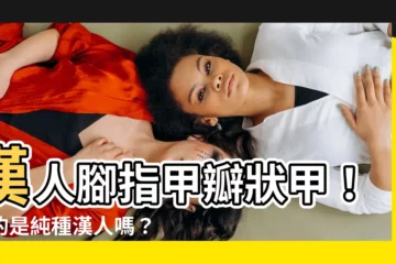 【漢人 腳指甲】漢人腳指甲瓣狀甲！真的是純種漢人嗎？