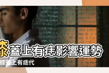 【左腿膝蓋下有痣代表什麼】膝蓋上有痣影響運勢嗎 |膝蓋上有痣代表什麼 |膝蓋有痣代表什麼 |