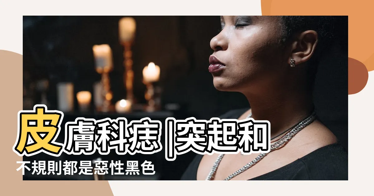 【痣變大變凸】皮膚科痣 |突起和不規則都是惡性黑色素瘤徵兆醫 |醜小鴨法則 |