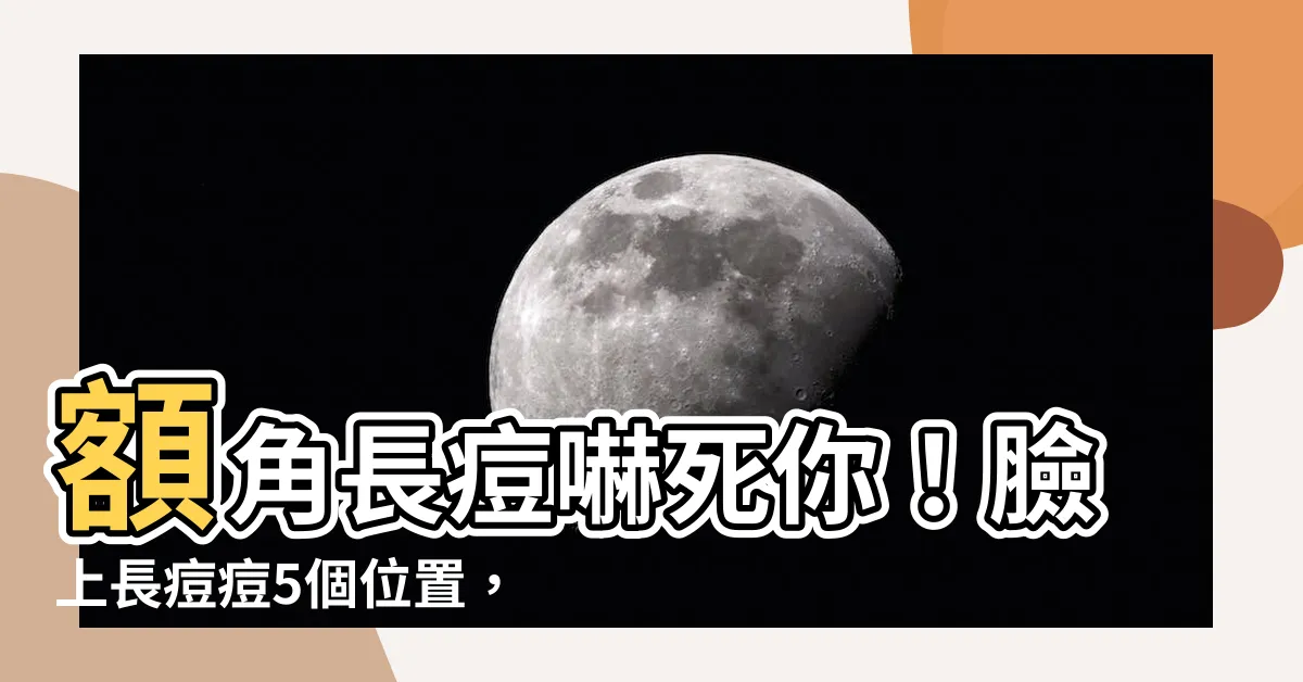 【額角暗瘡】額角長痘嚇死你！臉上長痘痘5個位置，竟然代表你的健康出狀況