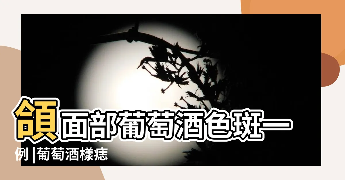 【葡萄酒色斑】頜面部葡萄酒色斑一例 |葡萄酒樣痣 |葡萄酒色斑 |
